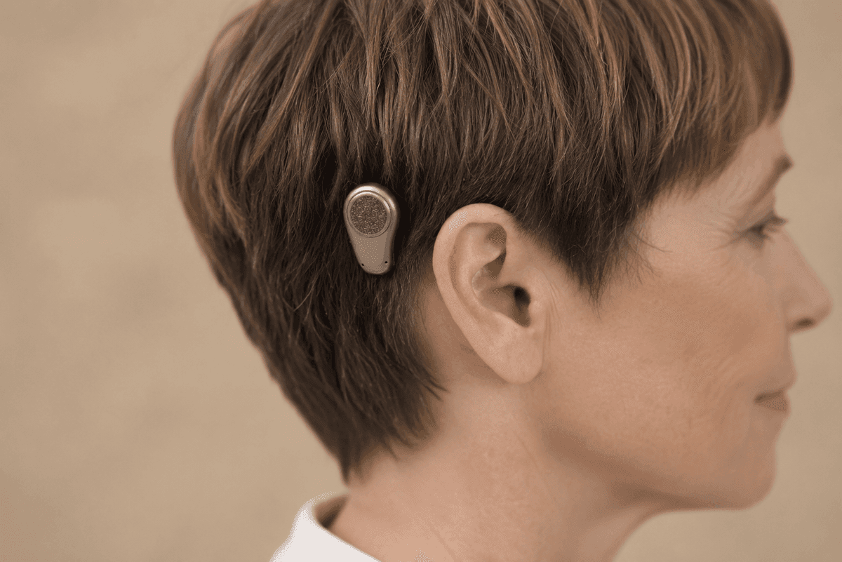 Person wearing a bone-anchored hearing device
